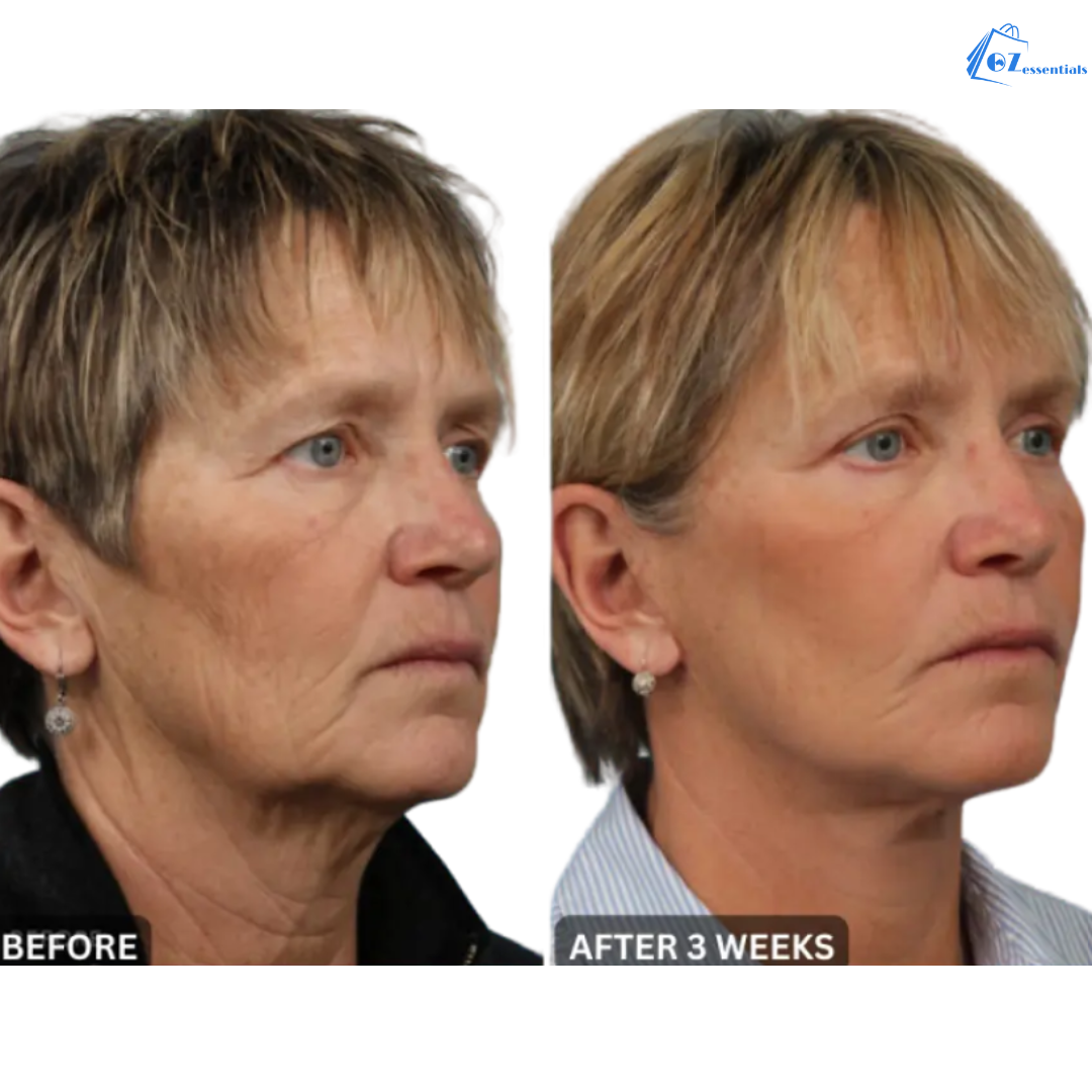 RejuvaGlow Anti-Wrinkle Massager